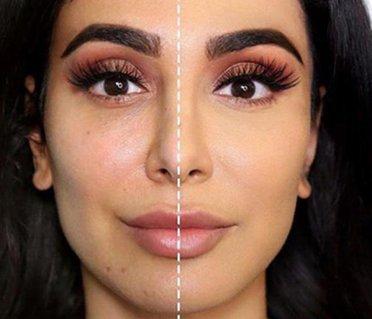 Comment choisir une fondation