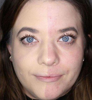 Comment choisir une fondation